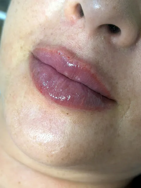 Close do resultado de harmonização labial